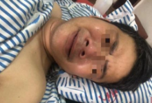江西小伙因“百万年薪”被骗到缅甸从事电信诈骗，逃跑时遭殴打至手腿粉碎性骨折