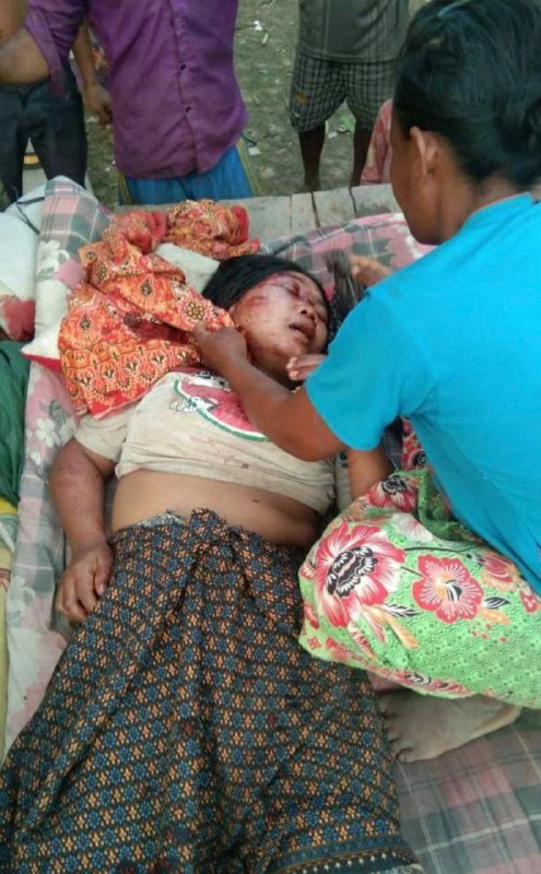 【柬单网综合报道】据柬媒消息，2月23日上午，上丁省暹邦县，一名柬籍男子涉嫌持锄头将妻子打成重伤，被押送上丁省初级法院审理。